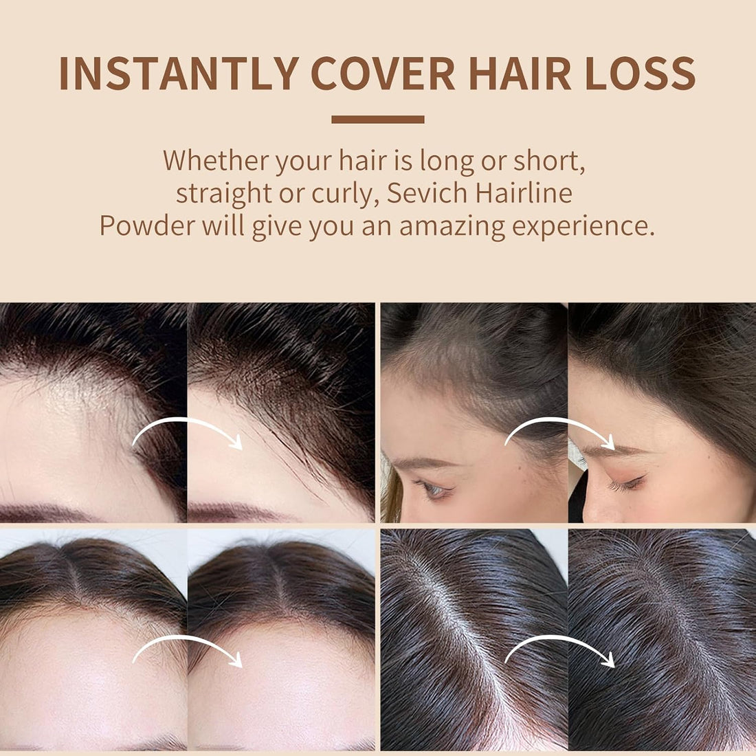 Sevich Hairline Powder,Instantly Conceals Hair Loss, Root Touch up Powder, Hair Shadow Toppers for Women & Men, Touch Up for Thinning Gray Hair, Windproof & Sweatproof,Dark brown
